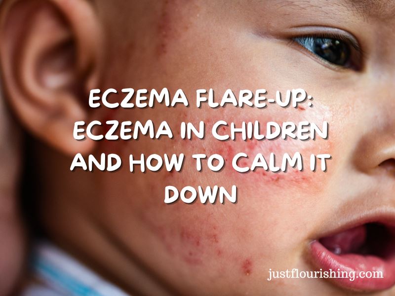 Eczema in Children 